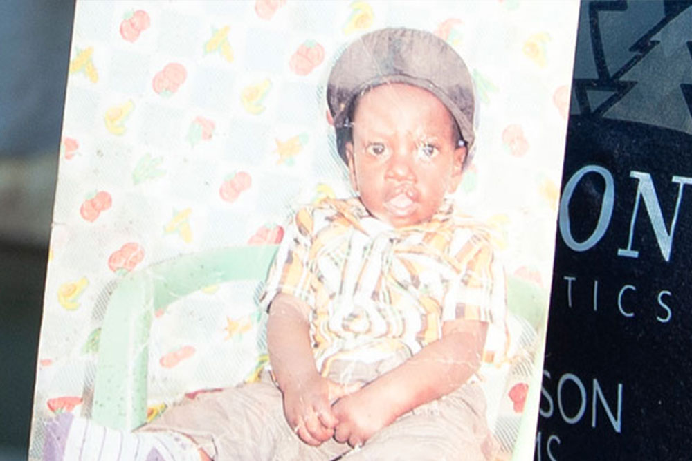 David before cleft surgery